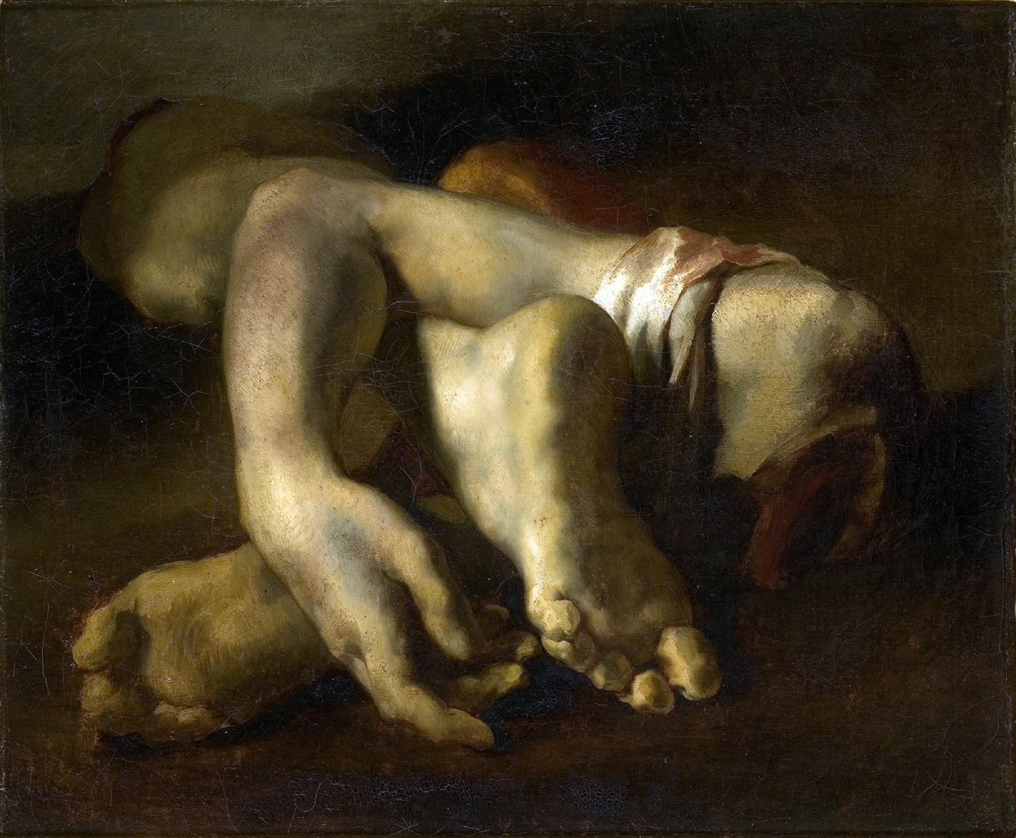 Théodore Géricault, Studio di arti amputati, 1818-1819, olio su tela, 52x64cm., Musée Fabre, Montpellier